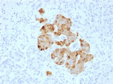 Anti Chromogranin A CHGA Antibody Rabbit Polyclonal Antibody IHC P