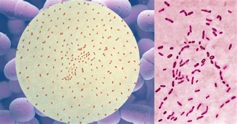 Biochemical Test Of Bordetella Pertussis