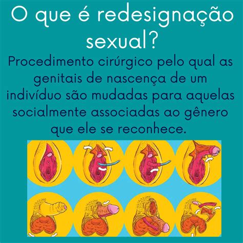 Cirurgia De RedesignaÇÃo Sexual Fisioterapia