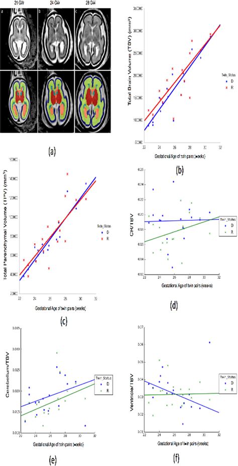 1052 Brain Composition Differences In Fetuses After Laser Surgery For