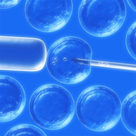 Stem Cell Therapy For Multiple Sclerosis Packages In Greece