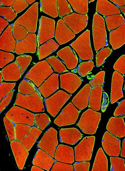 Skeletal Muscle Fibers Light Micrograph Science Art Science And