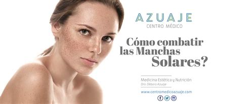 Tratamientos Para Combatir Las Manchas Solares Centro Médico Azuaje