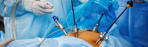 Laparoscopic Surgery In Malad Dr Ritu Jain