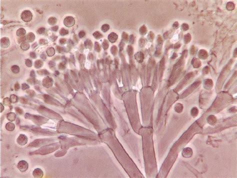 Mold Inspectors and Spore Levels.