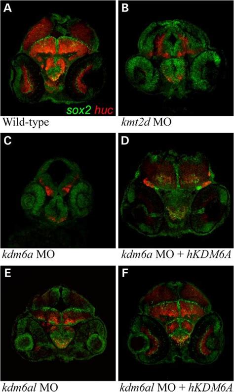 Kabuki Syndrome Genes Kmt2d And Kdm6a Functional Analyses Demonstrate