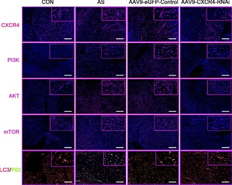 Blockade Of CXCR4 Promotes Macrophage Autophagy Through The PI3K AKT