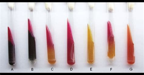 Triple Sugar Iron Tsi Agar Principle Results And 58 Off