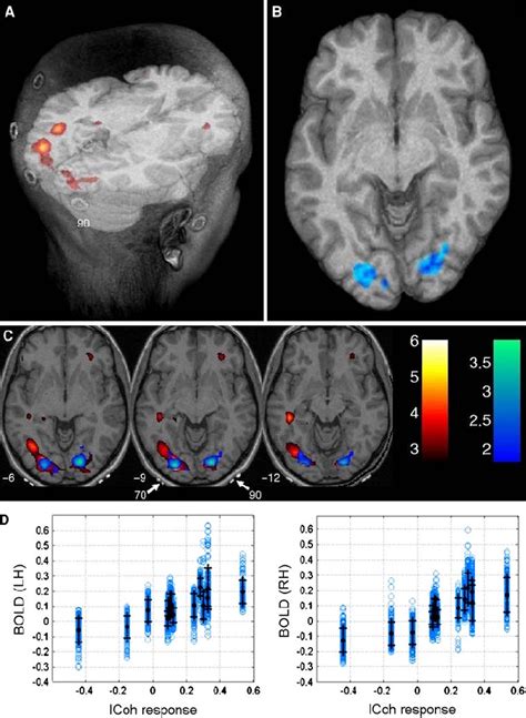 Interhemispheric Eeg Coherence Icoh Correlates With Potentiation Of