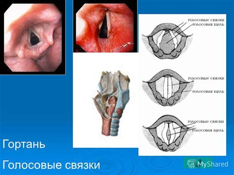 Презентация на тему: "Строение и функции дыхательной системы. Общий ...