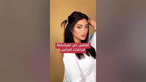 أفضل حل لتغطية فراغات الراس🤩فراغاتالشعر Youtube