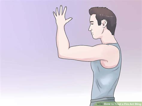 How to Treat a Fire Ant Sting: 14 Steps (with Pictures) - wikiHow