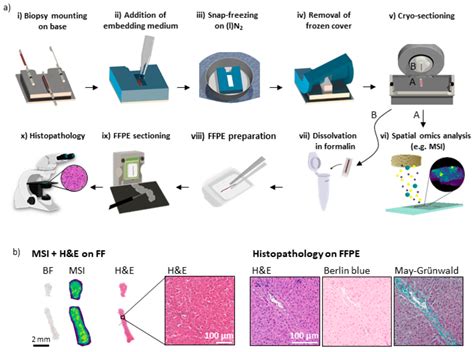 Cancers Free Full Text Spatial Omics Imaging Of Fresh Frozen Tissue And Routine Ffpe