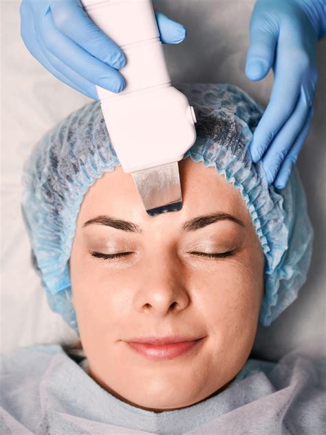 The Magic Of Chemical Peel Process A Step By Step Guide To Flawless