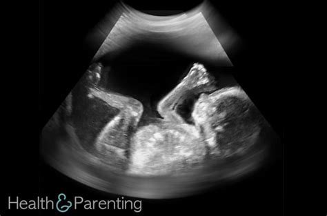 How Do Ultrasounds Work Health Parenting