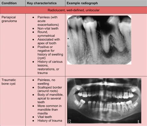 Bootcamp S Radiographic Bone Lesions To Know For The Inbde Inbde