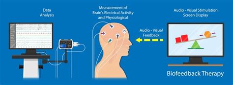 Neurofeedback Brainworks Holistic Therapy