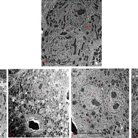 A An Electron Micrograph Of The Liver From Control Group Showing A Download Scientific Diagram