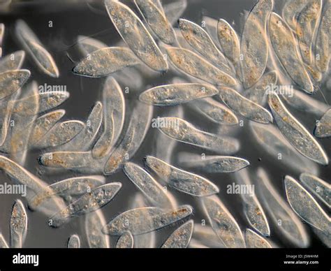 Kultur Zellen Mikroskop Mikroskopisch Kleine Einzeller Protozoen Schon