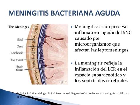 Neuropsicologia Meningitis 4940 Hot Sex Picture