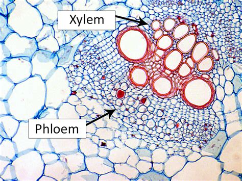 Types of Plant Cell: Structure, Functions, Labeled Diagram