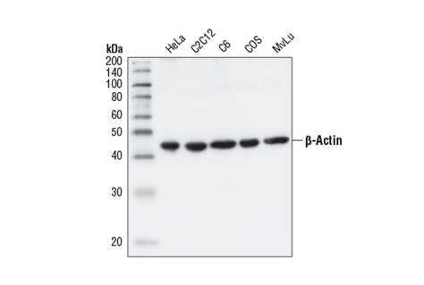 CST - β-Actin Antibody