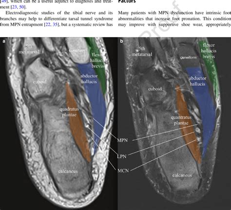 Lateral Medial Plantar Nerve