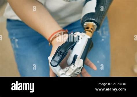 Female Using Wireless Bionic Prosthesis For The First Time Robotic