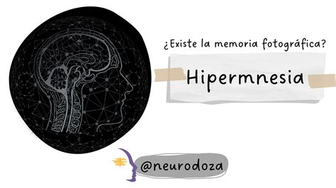 ND 171022 1 Hipermnesia NeuroDoza