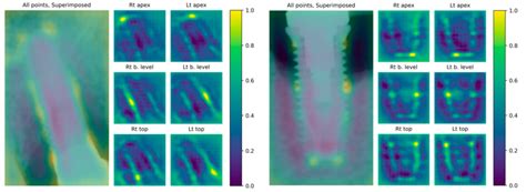 Examples Of The Keypoint Heat Maps The Likelihood Of Each Pixel Of