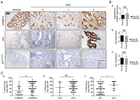 Expression Levels Of Hnrnp K And P Waf Cip Are Associated With