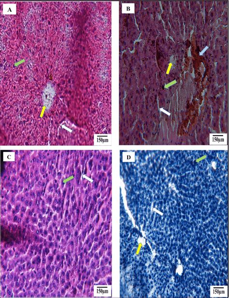 Histopathological Examinations Of The Liver Of Different Experimental