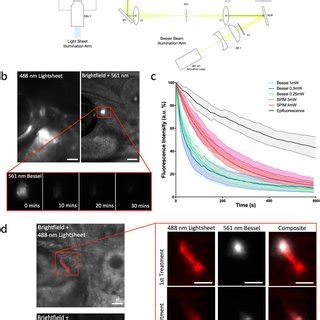 Introduction Of A Bessel Beam Into The Imaging Path Of The SPIM Set Up