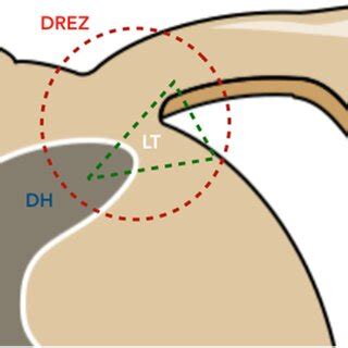 Cross section of a posterior part of left cervical spinal cord with ...