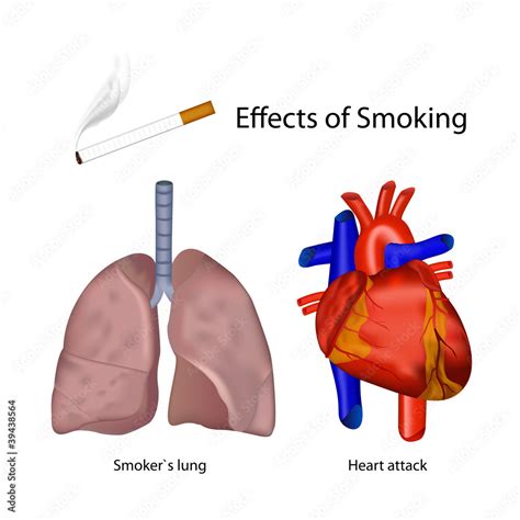 Smoking Effects Of The Human Body Vector Illustration Stock Vector