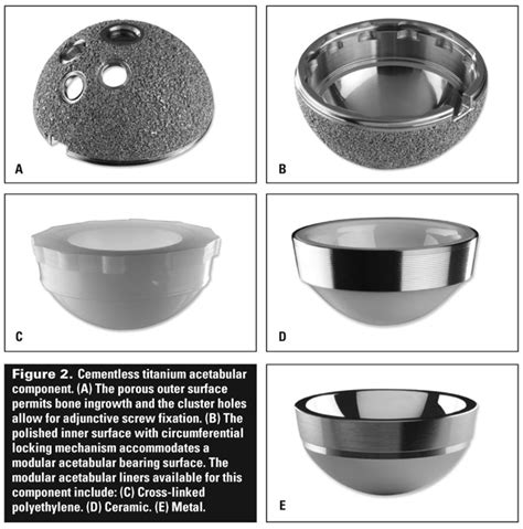 Total Hip Arthroplasty Techniques And Results British Columbia Medical Journal