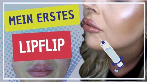 Meine Lip Flip Erfahrung Botox In Den Lippen Youtube