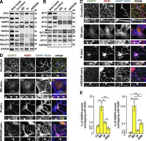 Different Astrocyte Culture Types Express The Same Vesicle Associated