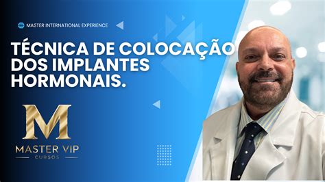 TÉCNICA DE COLOCAÇÃO DOS IMPLANTES HORMONAIS drjulio Hotmart