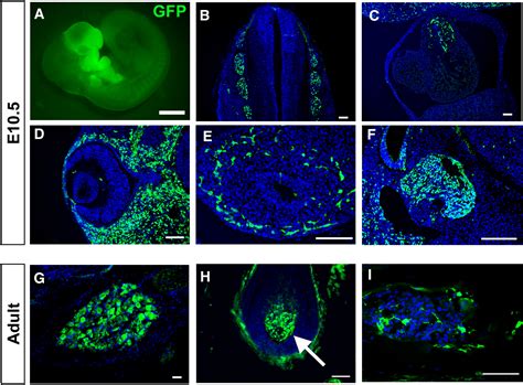 Ontogeny And Multipotency Of Neural Crest Derived Stem Cells In Mouse