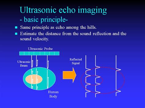 Foundations of Medical Ultrasonic Imaging Physics of ultrasound