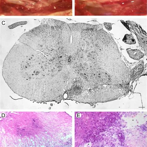 Immunohistochemical Analysis Of The Spinal Cord Lamina Ix