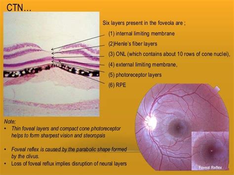 Retina And Layers