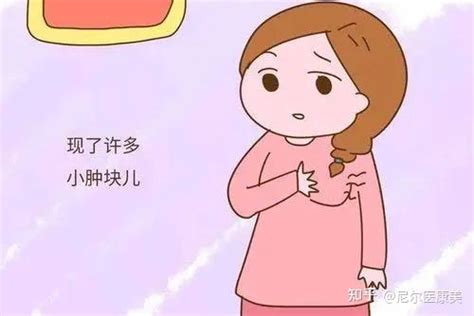 乳腺结节和乳腺增生的早期症状，看看是不是你 知乎