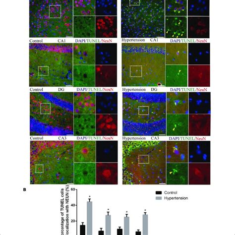 Angiotensin II Induced Hypertension Promotes Neuronal Apoptosis In