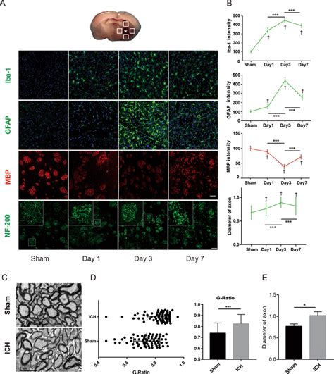 Glia Cell Activation And Myelin Damage Were Assessed From Day To Day