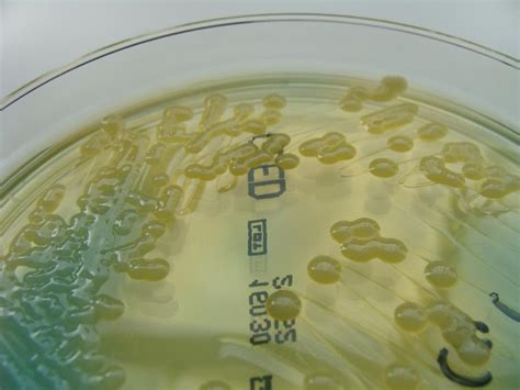 Klebsiella Pneumoniae Colony Morphology