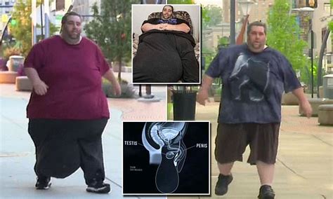 Man Has 132 Pound Scrotum