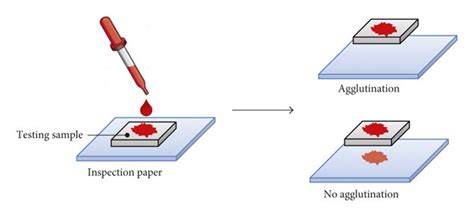 A schematic diagram of the blood agglutination test. | Download ...