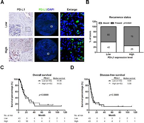 Figure 1 From Low Cd8 T Cell Infiltration And High Pd L1 Expression